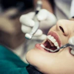 Best cosmetic orthodontics in Dubai